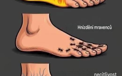 Syndrom neklidných nohou: Příčiny a účinná léčba.