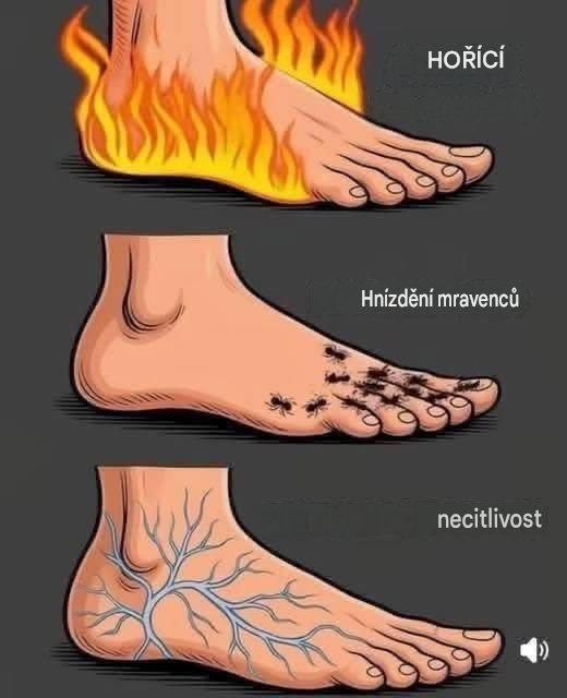 Syndrom neklidných nohou: Příčiny a účinná léčba.