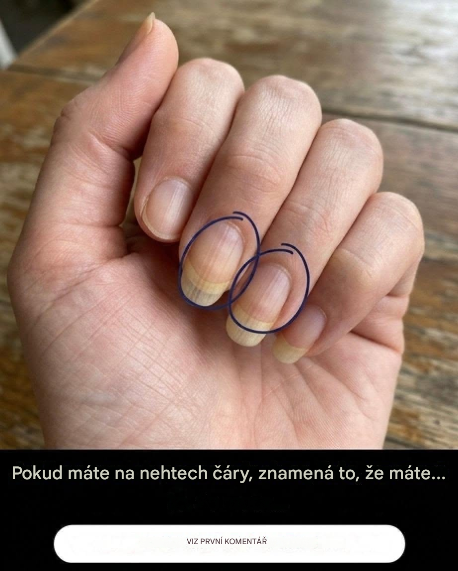 Pokud máte na nehtech vlnky, co znamenají