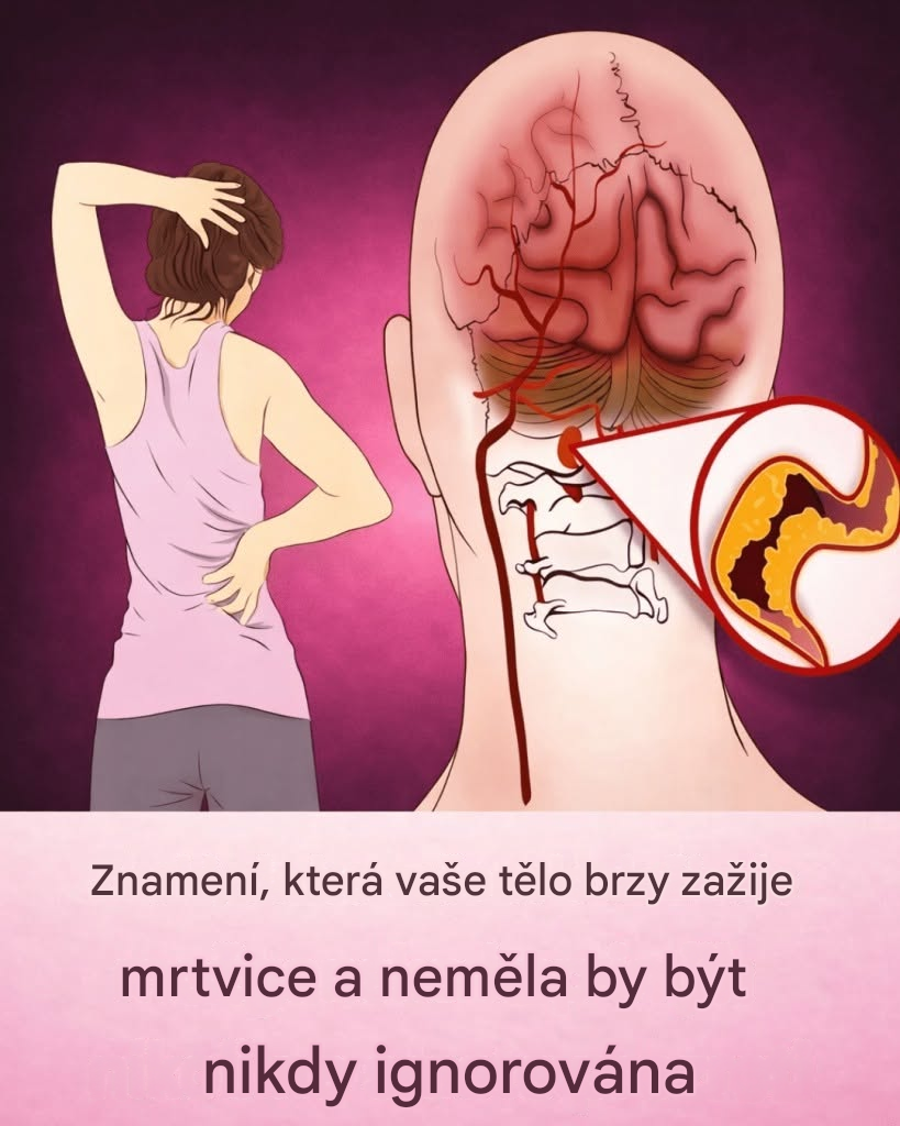 10 včasných varovných signálů mrtvice, které by měl znát každý, aby mohl včas jednat