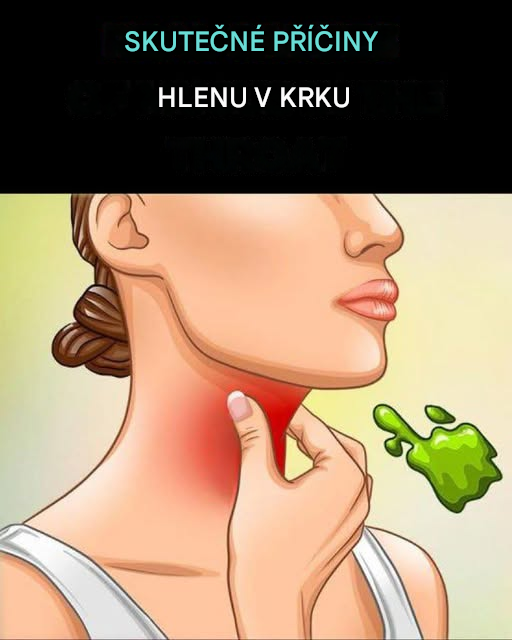 Skutečné příčiny neustálého hlenu a hlenů v krku a jak se jich zbavit