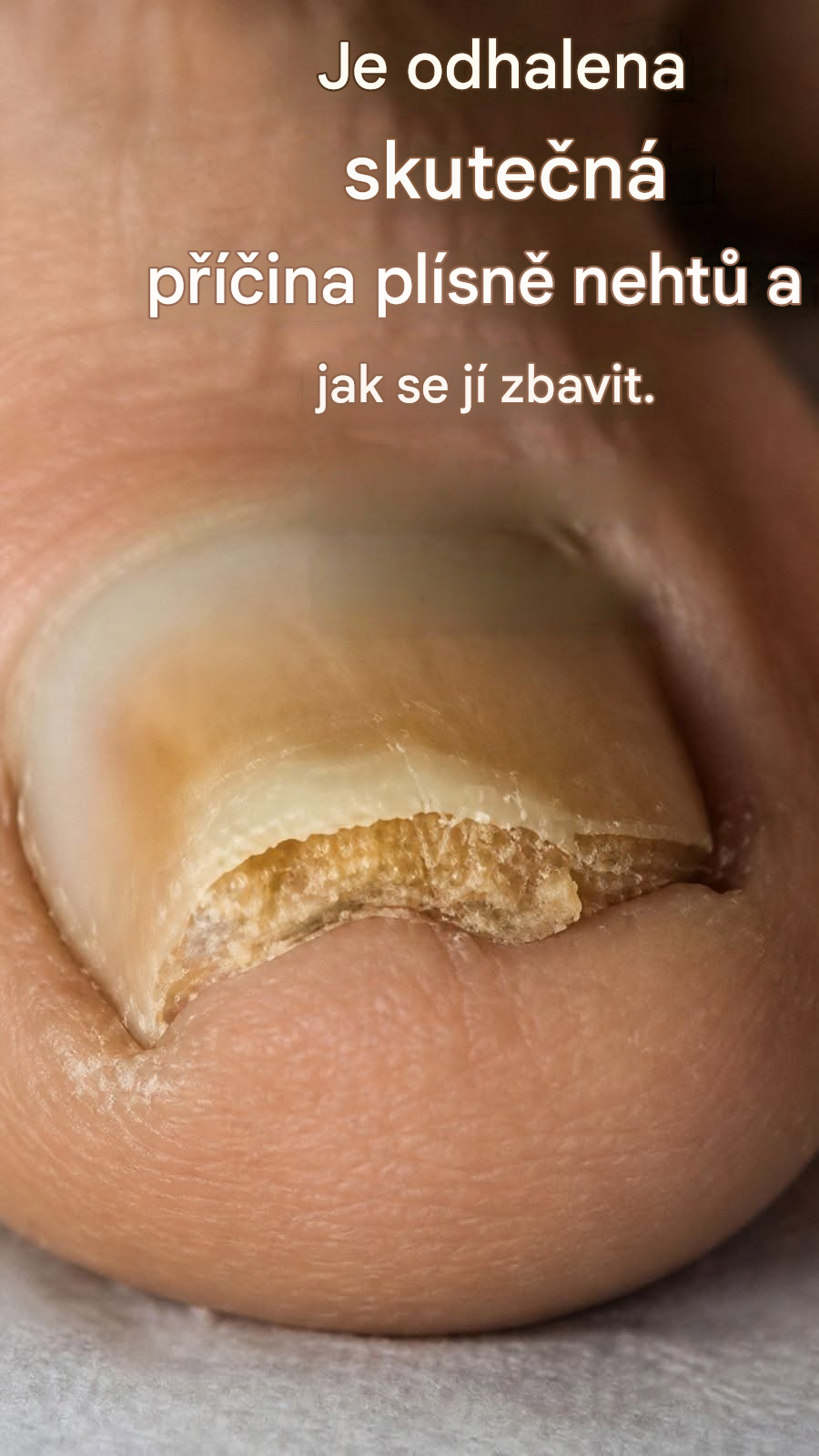 Elimina los hongos de las uñas de forma permanente se 2 přírodními složkami.