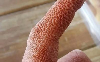 Odhalena šokující lékařská záhada: náhlá a bolestivá zranění v obličeji ženy vedla k neobvyklé diagnóze, která lékaře ohromila.