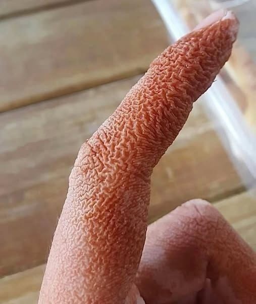 Odhalena šokující lékařská záhada: náhlá a bolestivá zranění v obličeji ženy vedla k neobvyklé diagnóze, která lékaře ohromila.