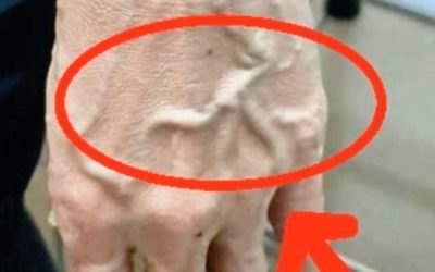 Pokud máte viditelné žíly, znamená to, že… Zobrazit více