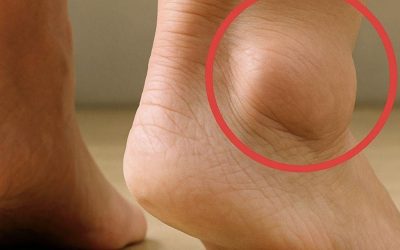 Oteklé nohy u starších dospělých: Časté příčiny a prevence