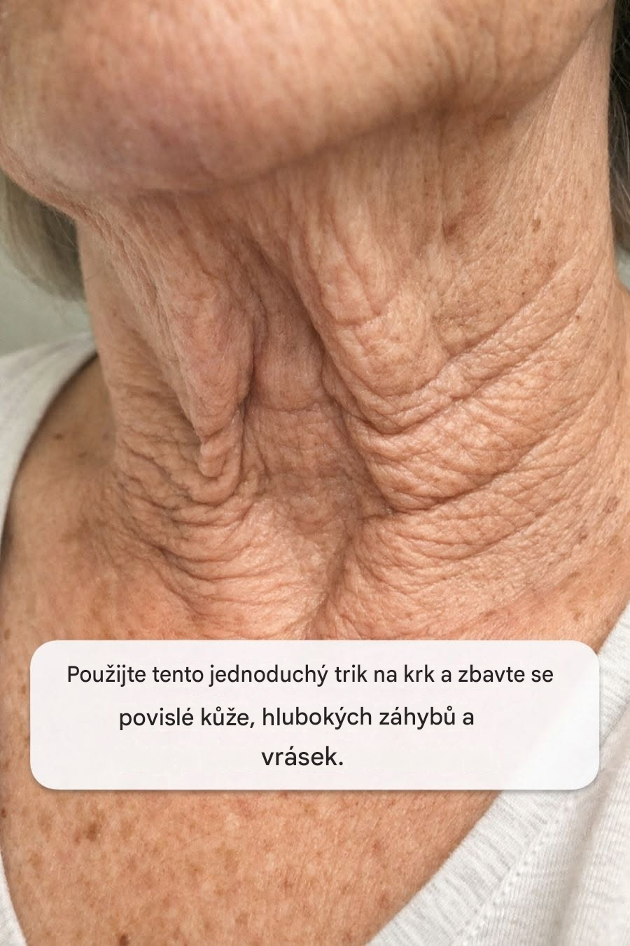 Použijte tento jednoduchý trik na krk a zbavte se povislé kůže, hlubokých záhybů a vrásek.