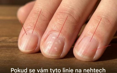 Proč se na nehtech s přibývajícím věkem vytvářejí tenké svislé linie?