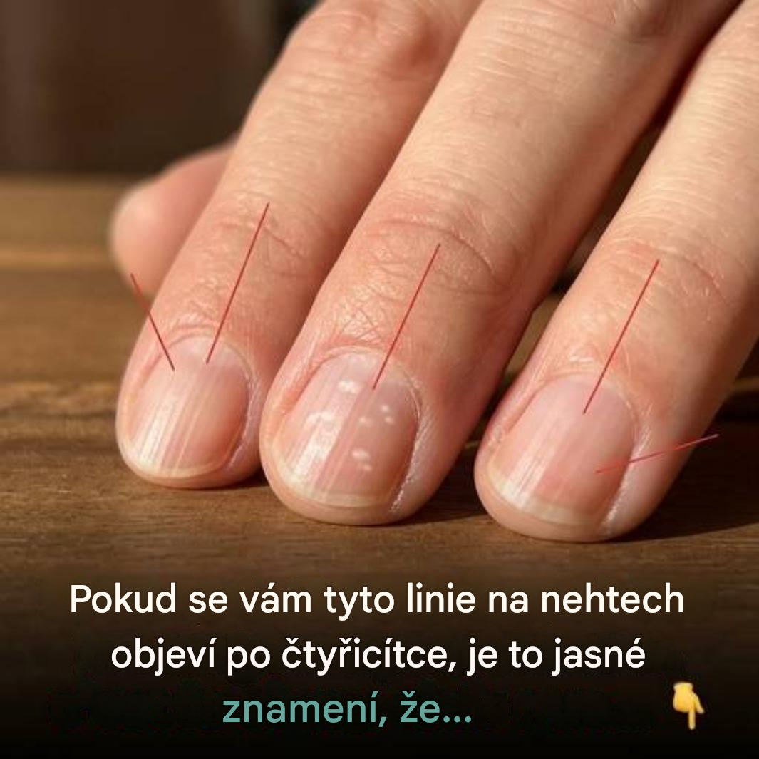 Proč se na nehtech s přibývajícím věkem vytvářejí tenké svislé linie?