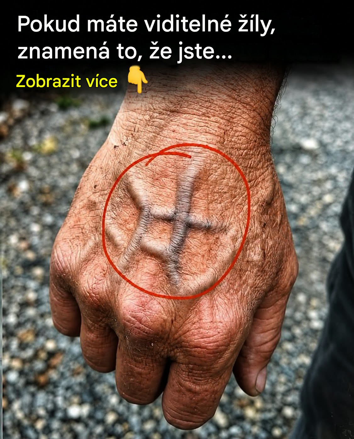 Kdy byste se měli znepokojovat žilkami, které se náhle objeví?