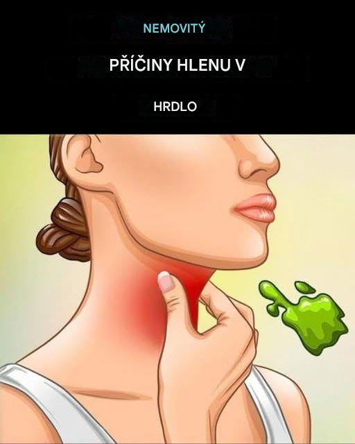 Skutečné příčiny přetrvávajícího hlenu a hlenů v krku a jak se jich zbavit!