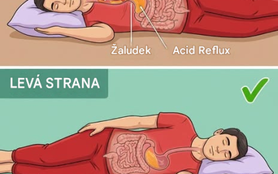 Kyselý reflux: proč je vaše poloha při spaní tak důležitá (a kterou stranu lékaři doporučují)