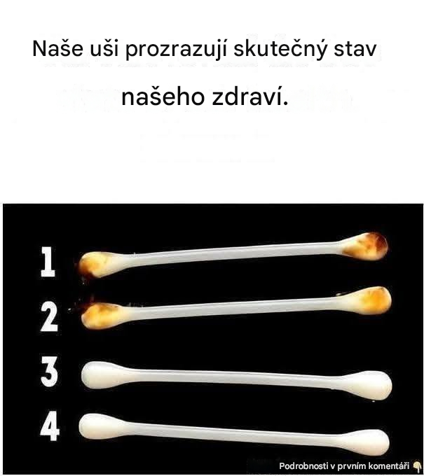 Naše uši prozrazují skutečný stav našeho zdraví