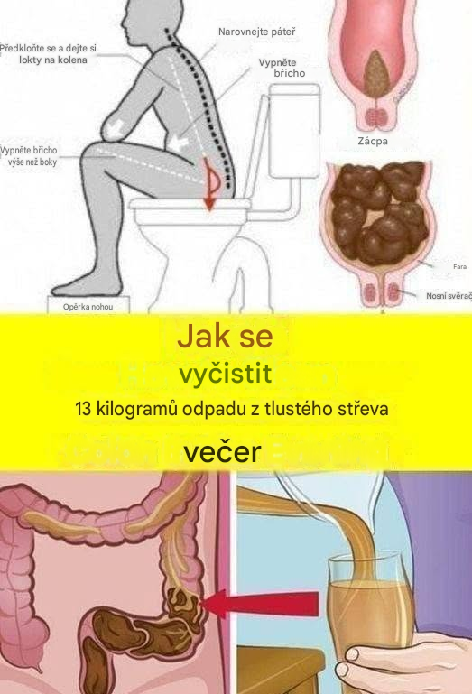 Naučte se, jak vyčistit tlusté střevo od 15 kilogramů odpadu za jednu noc