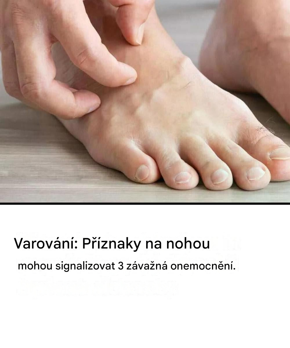 Svědivé nohy mohou být příznakem tří závažných zdravotních problémů.