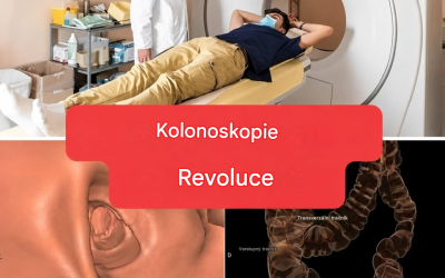Nová metoda: kolonoskopie již nebude invazivní vyšetření. (1/2)