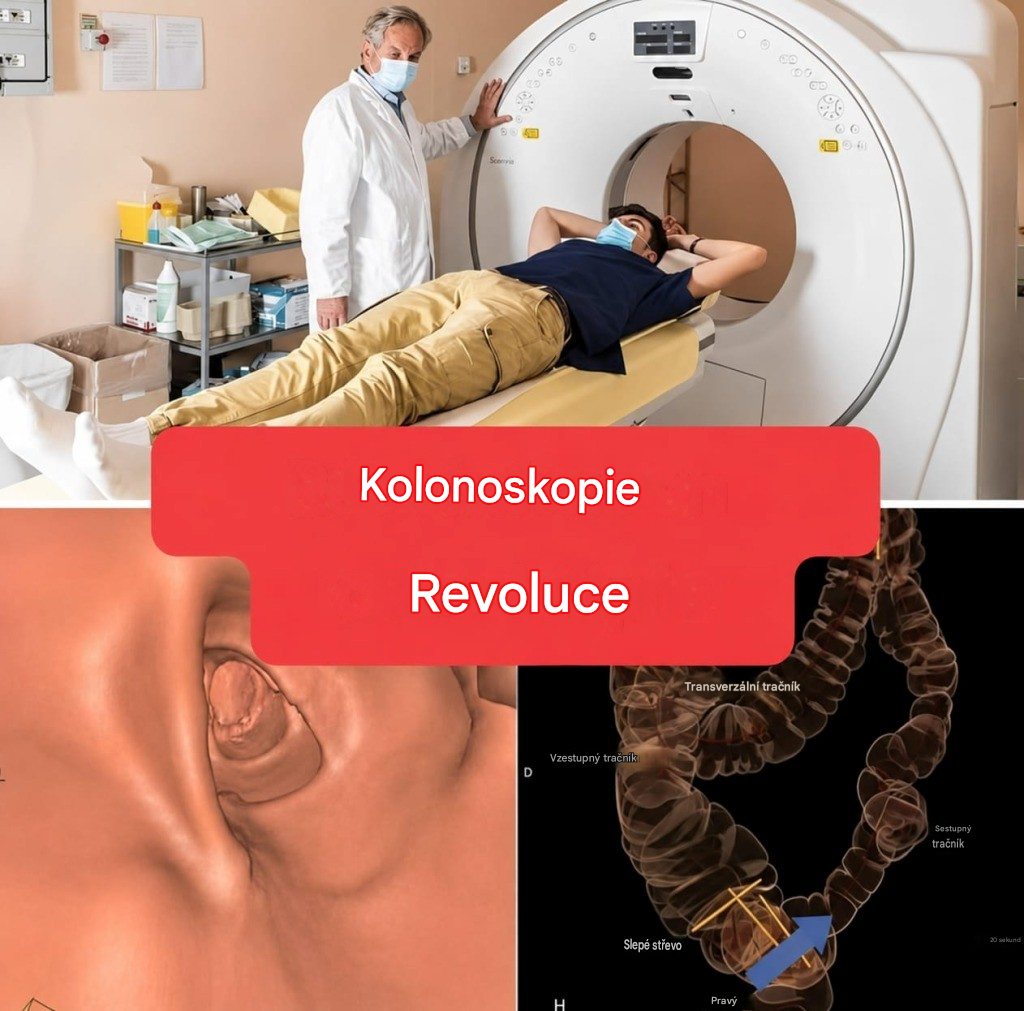 Nová metoda: kolonoskopie již nebude invazivní vyšetření. (1/2)