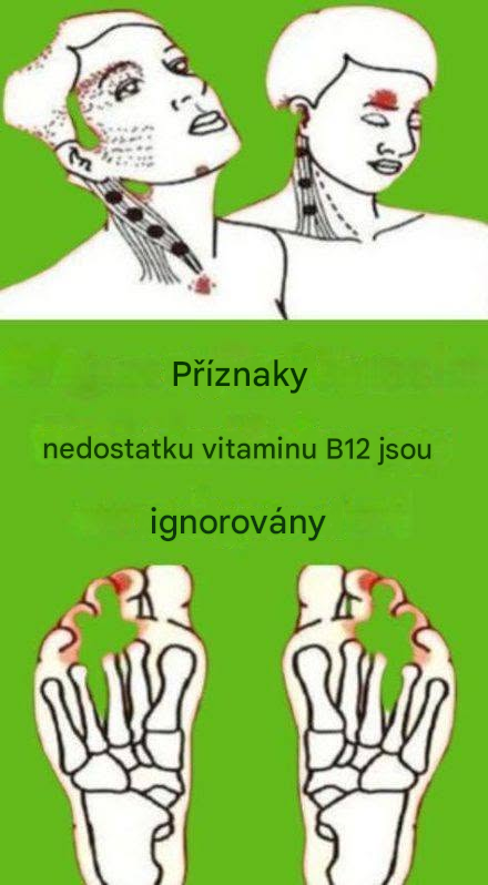 Příznaky nedostatku vitaminu B12 jsou ignorovány