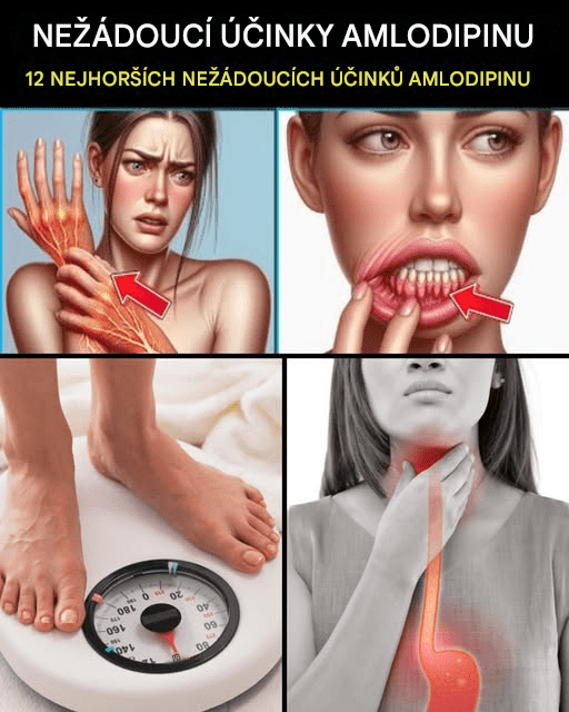 12 nejhorších vedlejších účinků amlodipinu, které byste NIKDY neměli ignorovat!