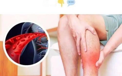 Jeden vitamín, který otevírá cévy a zlepšuje krevní oběh