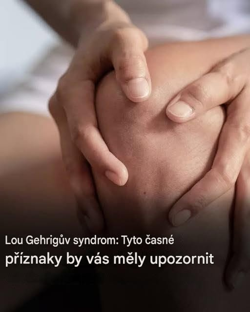 Lou Gehrigův syndrom: Zde jsou první příznaky tohoto onemocnění