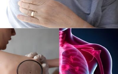 16 prvních příznaků, že se ve vašem těle rozvíjí rakovina