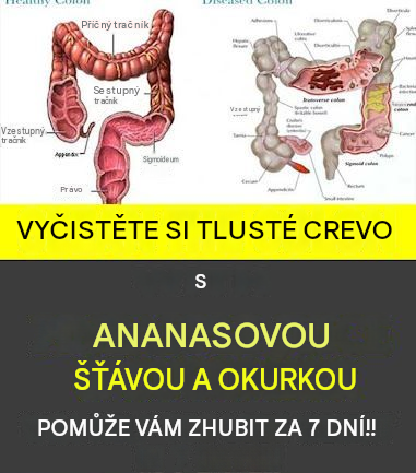 Ananasová šťáva a okurka pro čištění tlustého střeva za 7 dní a pomoc s hubnutím