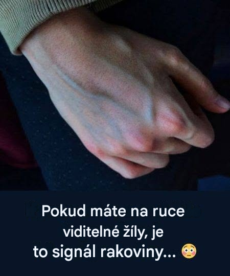 Co mohou žíly na vašich rukou prozradit o zdraví vašich jater