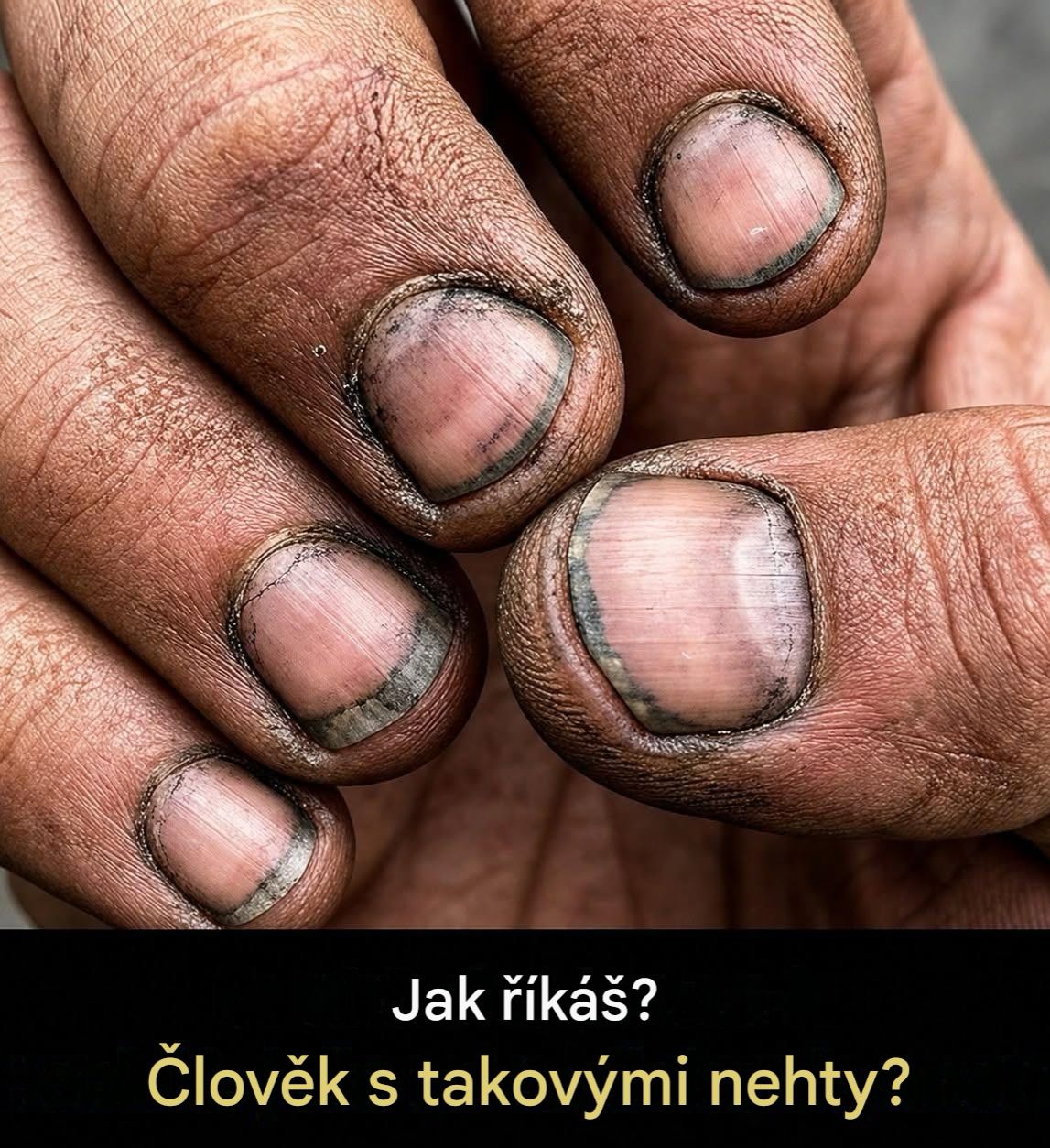 Špinavé nehty ne vždy znamenají nedostatek hygieny, ale spíše známku tvrdé práce.