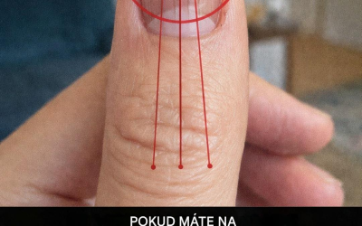 Linky na nehtech: Co mohou prozradit o vašem zdraví