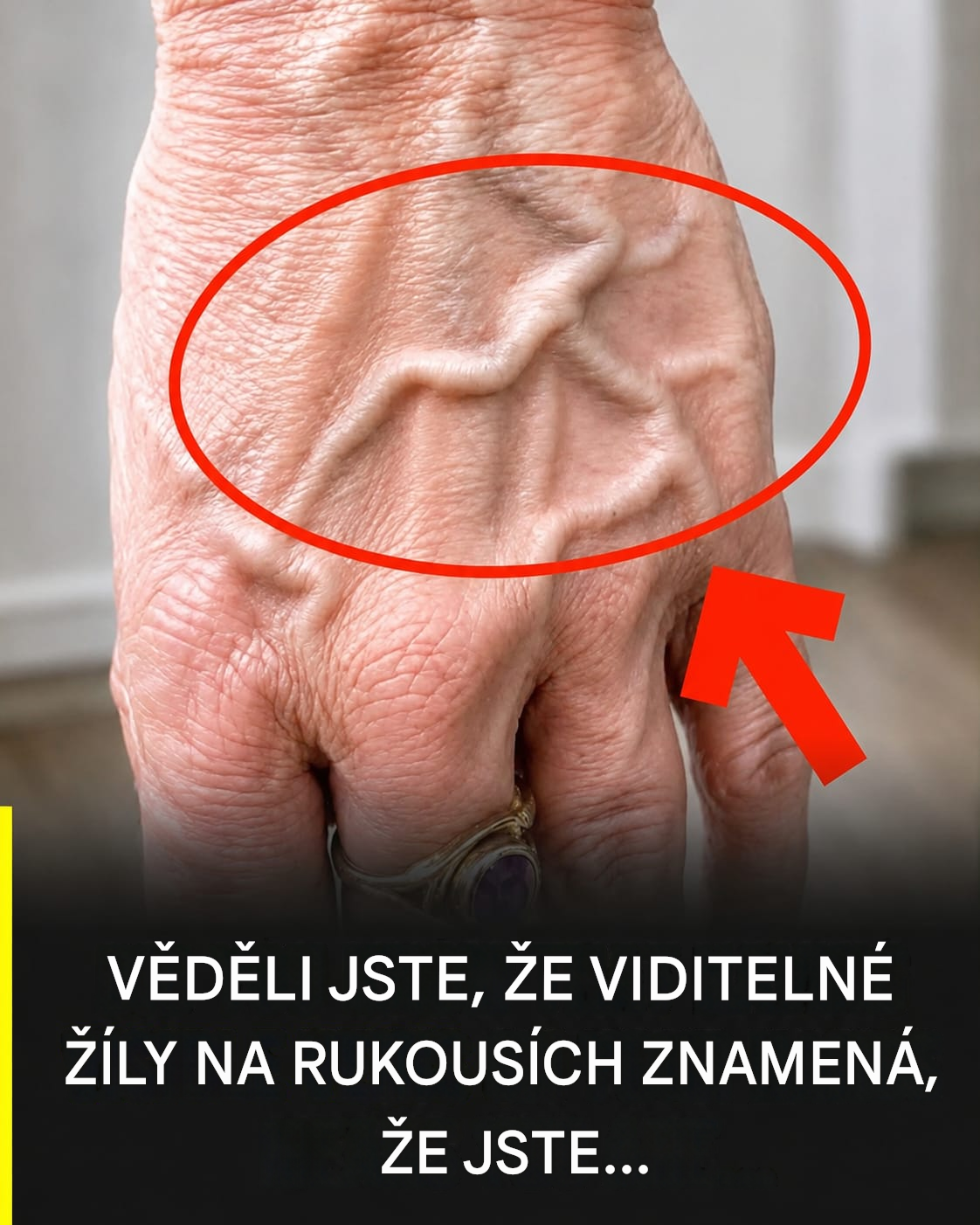 Věděli jste, že viditelné žíly znamenají, že jste… Zobrazit více