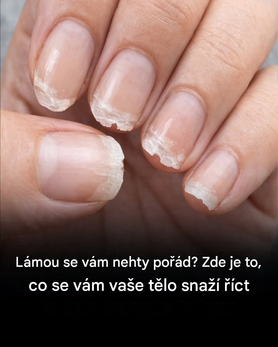Slabé nebo křehké nehty: Co se vám vaše tělo snaží říct