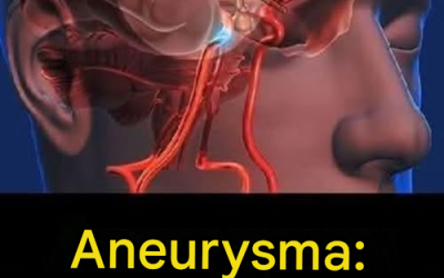 Aneuryzma: Příznaky, které byste neměli ignorovat…