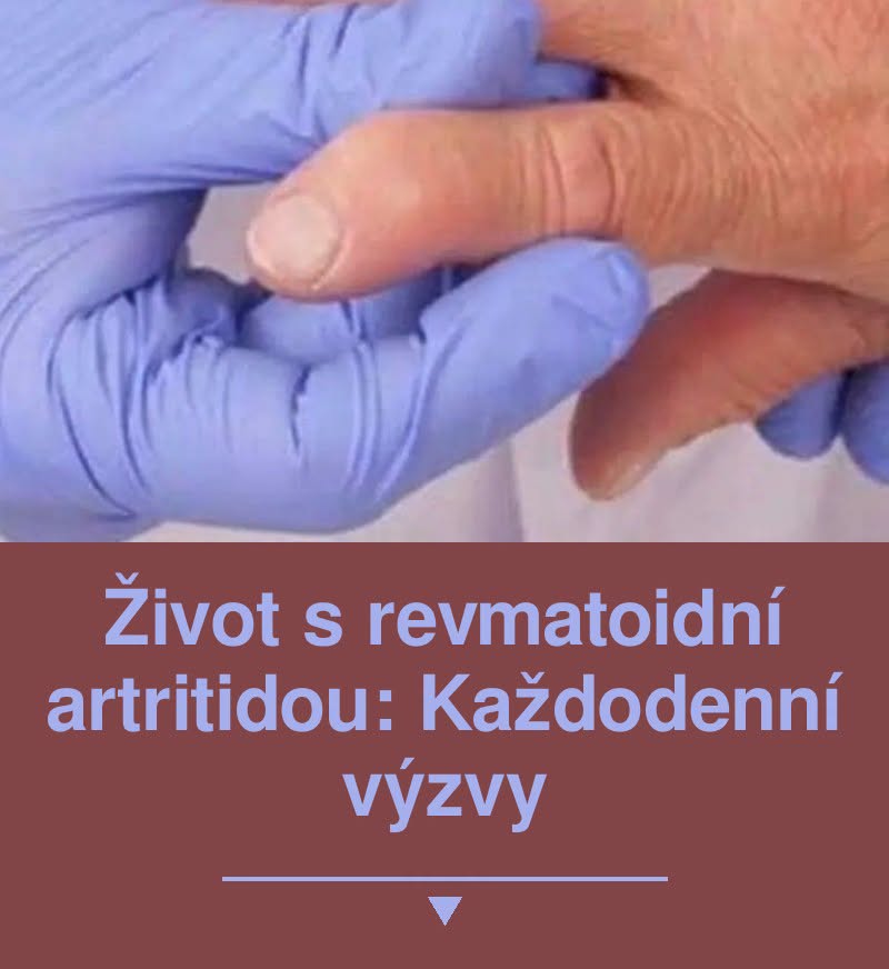 Život s revmatoidní artritidou: Každodenní výzvy