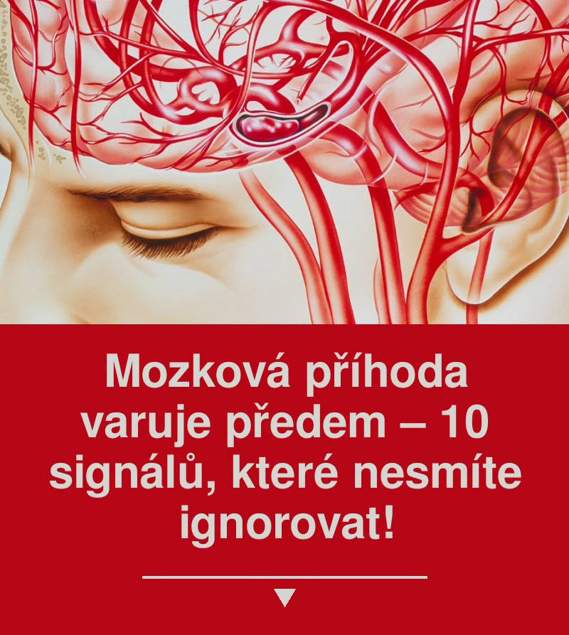 Mozková příhoda varuje předem – 10 signálů, které nesmíte ignorovat!
