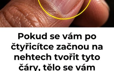 Pokud se vám po čtyřicítce začnou na nehtech tvořit tyto čáry, tělo se vám snaží něco naznačit