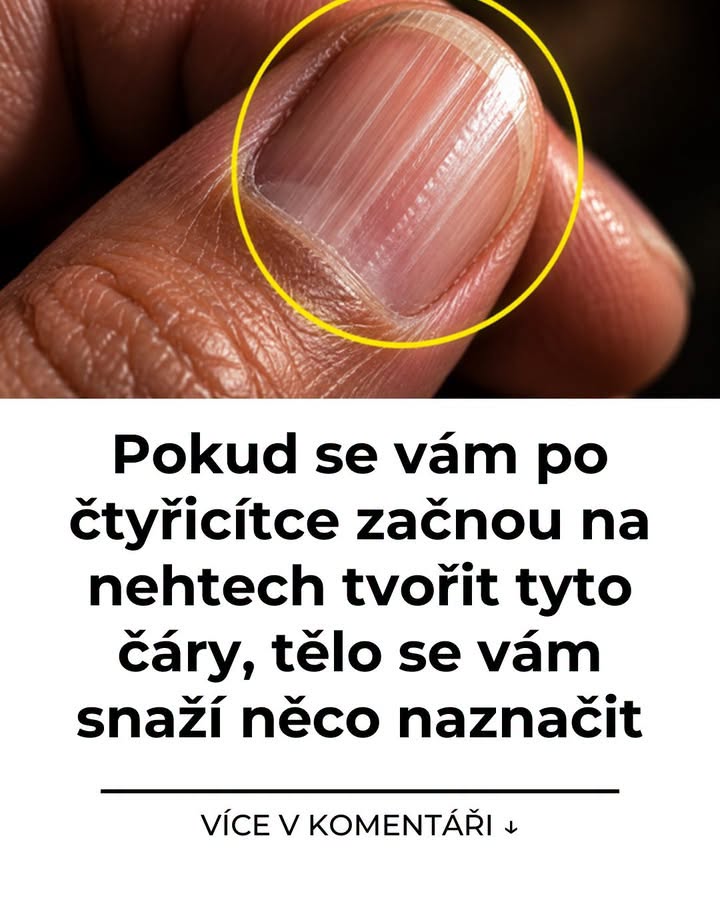Pokud se vám po čtyřicítce začnou na nehtech tvořit tyto čáry, tělo se vám snaží něco naznačit