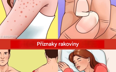 12 včasných varovných signálů, že se ve vašem těle mohou vyvíjet rakovinné buňky