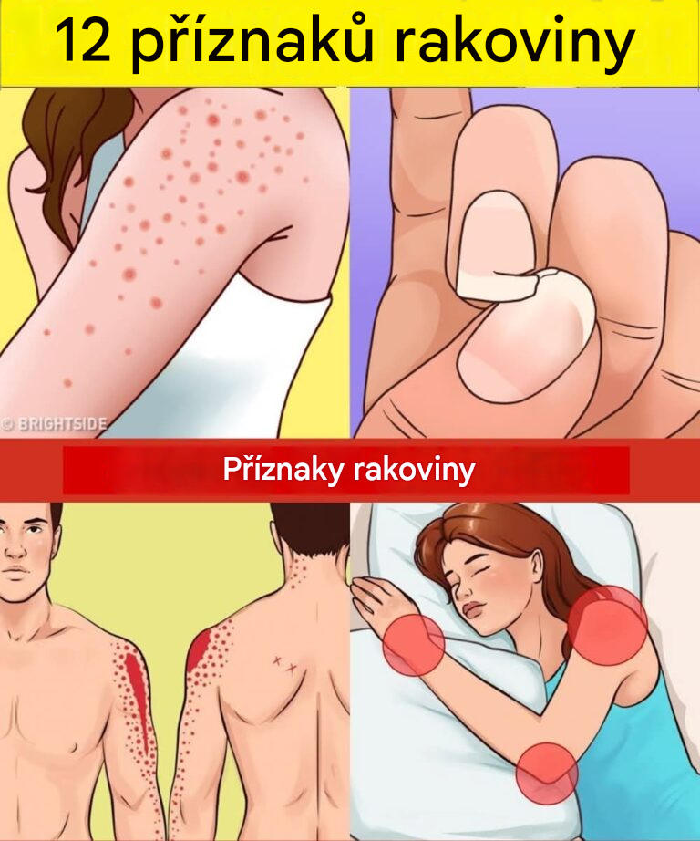 12 včasných varovných signálů, že se ve vašem těle mohou vyvíjet rakovinné buňky