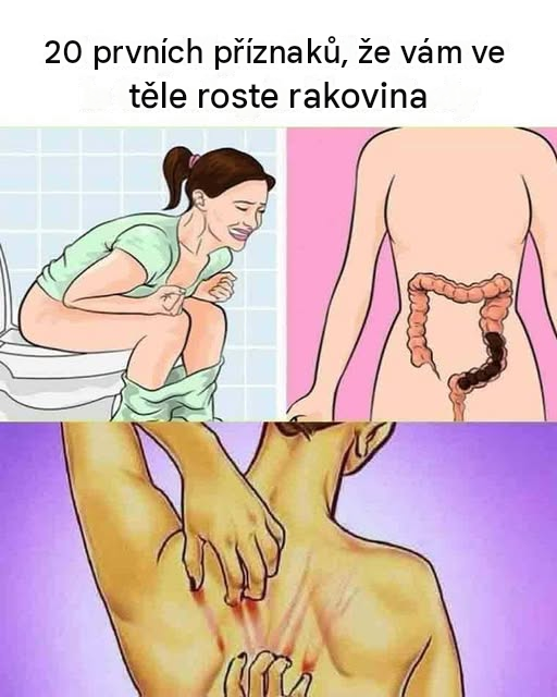 20 prvních příznaků, že vaše tělo bojuje s rakovinou